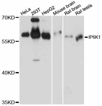 Western blot - IP6K1 antibody (144-12216)