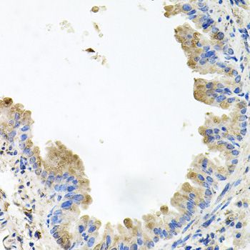 Immunohistochemistry - PIK3CB antibody (144-00982)