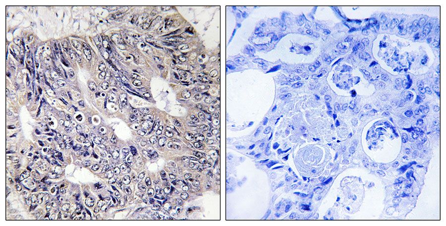 IHC