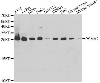 Western blot - PSMA2 Polyclonal Antibody (144-02504)