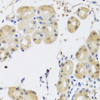 Immunohistochemistry - YAP1 Polyclonal Antibody (144-01001)