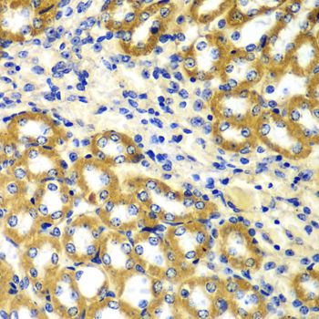 Immunohistochemistry - TOMM20 antibody (144-06774)
