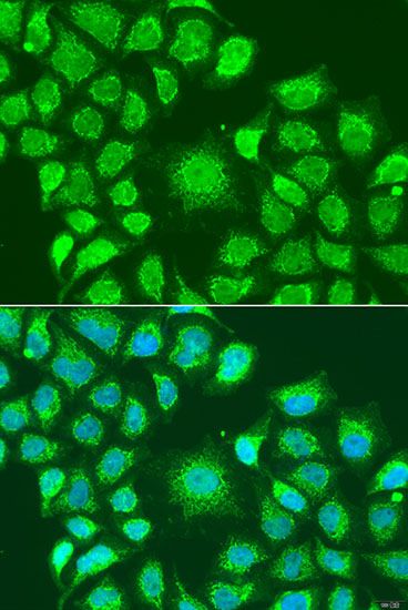 Immunofluorescence - ATG4D Polyclonal Antibody (144-07842)