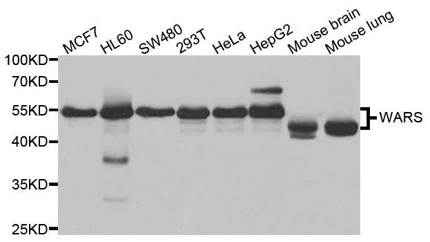 Western blot - WARS Polyclonal Antibody (144-05758)