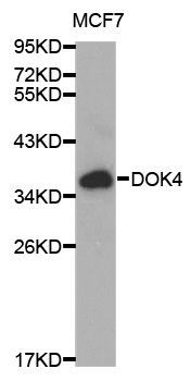 Western blot - DOK4 Polyclonal Antibody (144-00226)