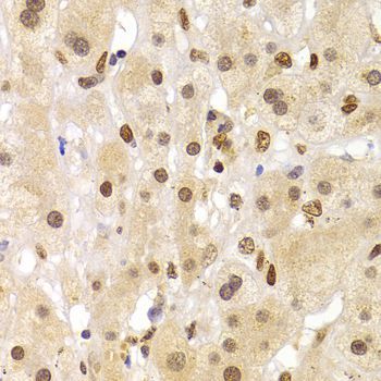 Immunohistochemistry - HNRNPA1 Polyclonal Antibody (144-07491)