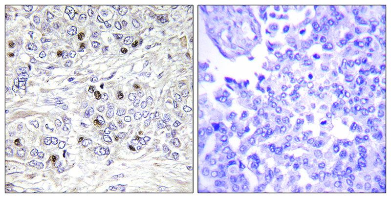 IHC