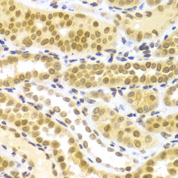 Immunohistochemistry - ELAVL1 Polyclonal Antibody (144-01608)