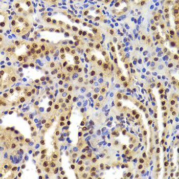 Immunohistochemistry - ANP32A Antibody (144-05768)
