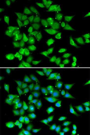 Immunofluorescence - NFATC3 antibody (144-06666)