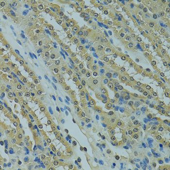 Immunohistochemistry - UBE2I Polyclonal Antibody (144-02193)
