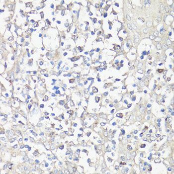 Immunohistochemistry - NFATC1 Polyclonal Antibody (144-01539)