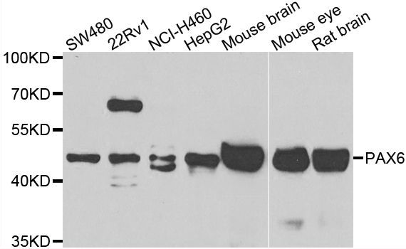Western blot - PAX6 antibody (144-07334)