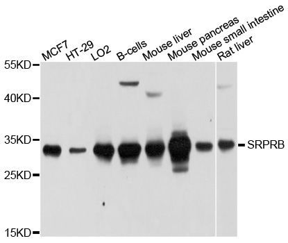Western blot - SRPRB Polyclonal Antibody (144-010591)