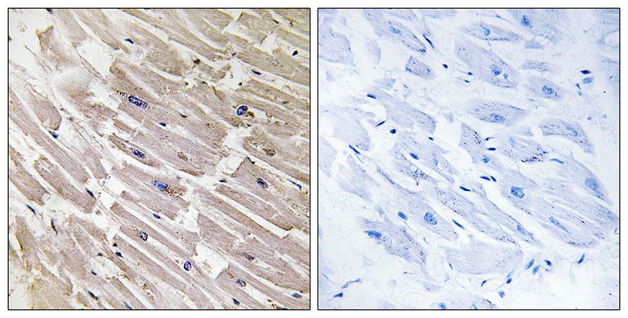 IHC