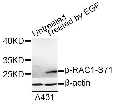 Western blot - Phospho-RAC1-S71 antibody (144-50086)