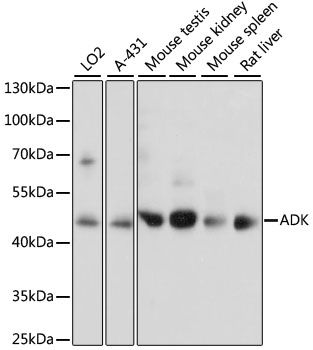 Western blot - ADK antibody (144-60886)