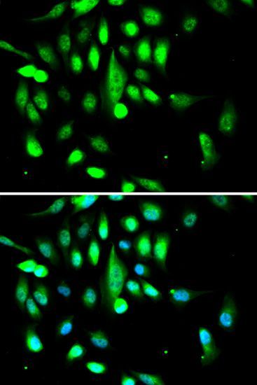 Immunofluorescence - CDK1 Polyclonal Antibody (144-00220)
