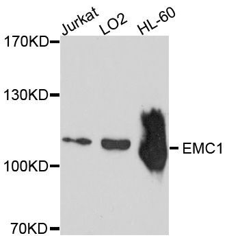 Western blot - EMC1 Polyclonal Antibody (144-10290)