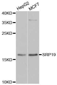 Western blot - SRP19 Polyclonal Antibody (144-06752)
