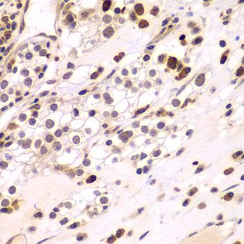 Immunohistochemistry - CEBPG Polyclonal Antibody (144-07279)