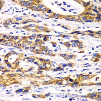 Immunohistochemistry - RPN1 antibody (144-06726)