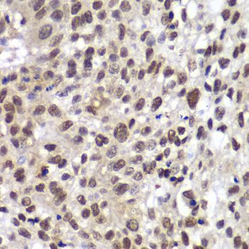 Immunohistochemistry - CHEK2 Polyclonal Antibody (144-60023)