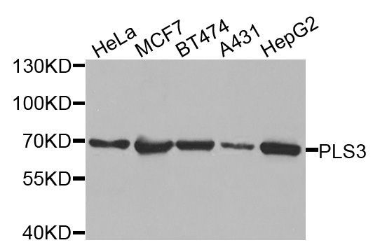 Western blot - PLS3 Polyclonal Antibody (144-03627)