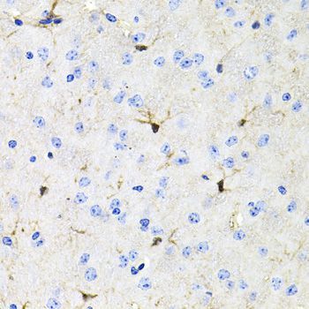 Immunohistochemistry - ACVR2A Polyclonal Antibody (144-01981)