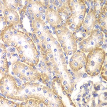 Immunohistochemistry - BMPR1B Polyclonal Antibody (144-02005)