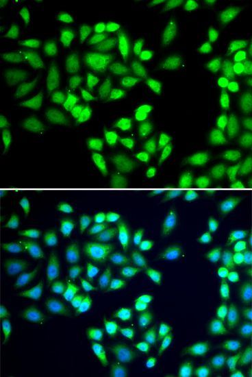Immunohistochemistry - [KO Validated] SGTA Polyclonal Antibody (144-07306)