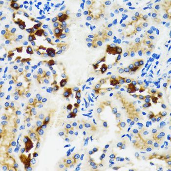 Immunohistochemistry - GABARAP antibody (144-12568)