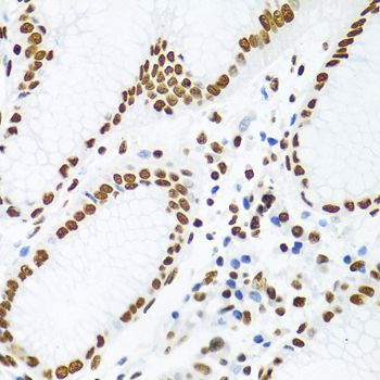 Immunohistochemistry - KHDRBS1 antibody (144-06101)