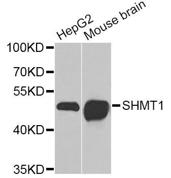 Western blot - SHMT1 Polyclonal Antibody (144-012489)