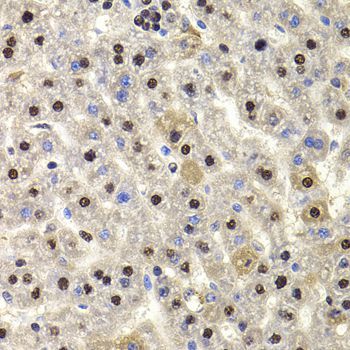 Immunohistochemistry - HIRIP3 antibody (144-07014)