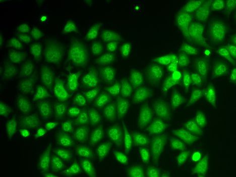 Immunofluorescence - AKR1A1 antibody (144-60399)