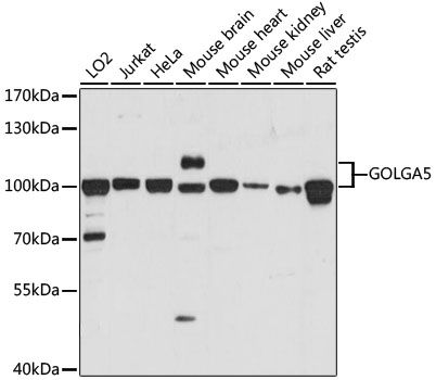 Western blot - GOLGA5 antibody (144-61189)