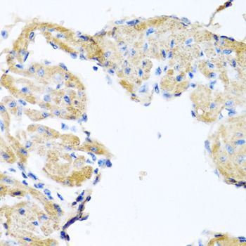 Immunohistochemistry - GPLD1 Polyclonal Antibody (144-06612)