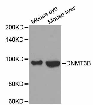 Western blot - DNMT3B Polyclonal Antibody (144-02899)