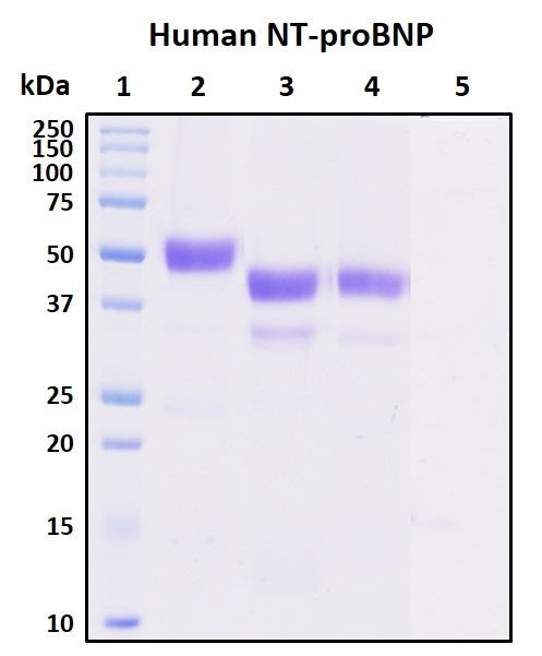 SDS-PAGE