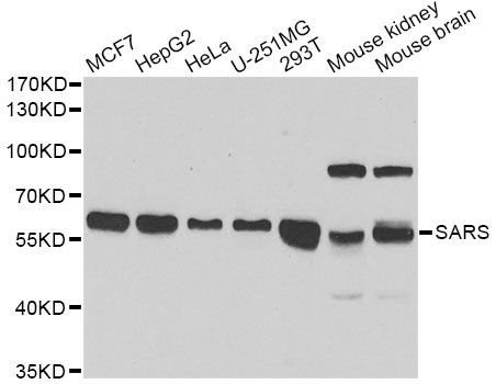 Western blot - SARS antibody (144-602970)