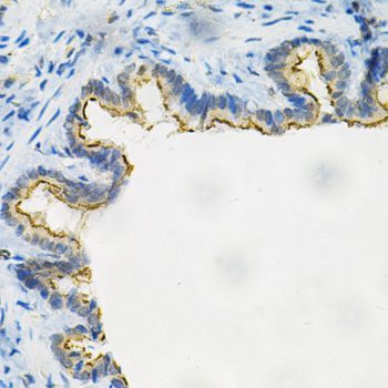 Immunohistochemistry - AKR1B1 Antibody (144-60529)