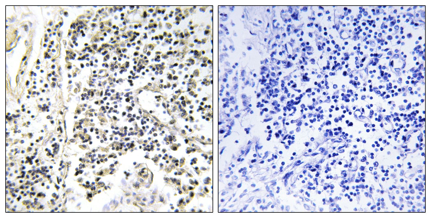 IHC