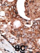 IHC-P