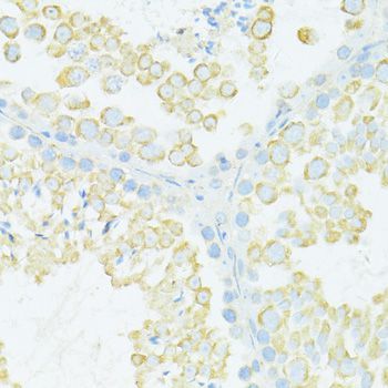 Immunohistochemistry - MYH10 antibody (144-012029)