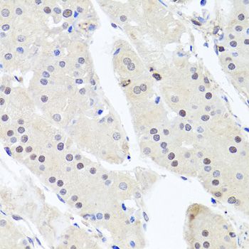 Immunohistochemistry - GSK3B Polyclonal Antibody (144-06164)