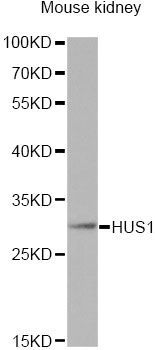 Western blot - HUS1 antibody (144-60528)