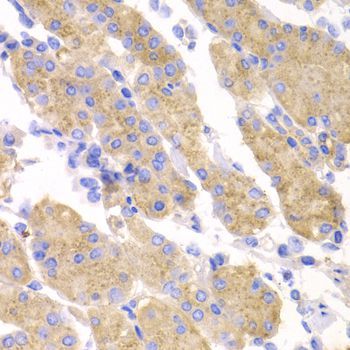 Immunohistochemistry - SMYD4 Polyclonal Antibody (144-07310)