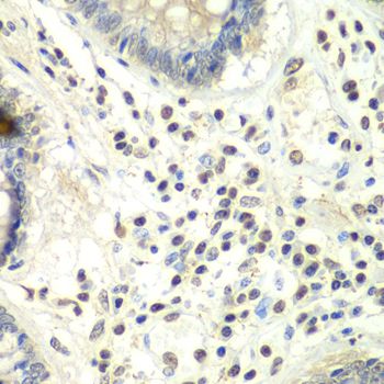Immunohistochemistry - PRMT5 antibody (144-01520)
