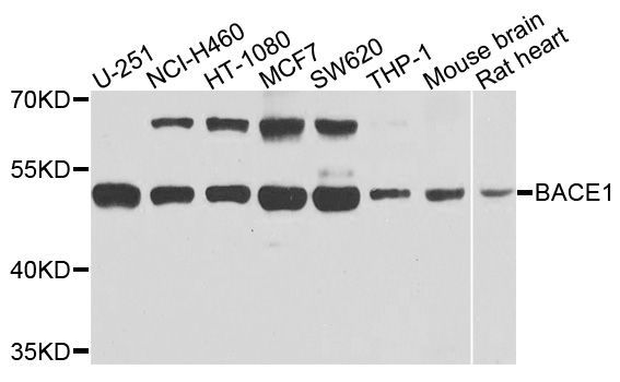 Western blot - BACE1 antibody (144-05266)